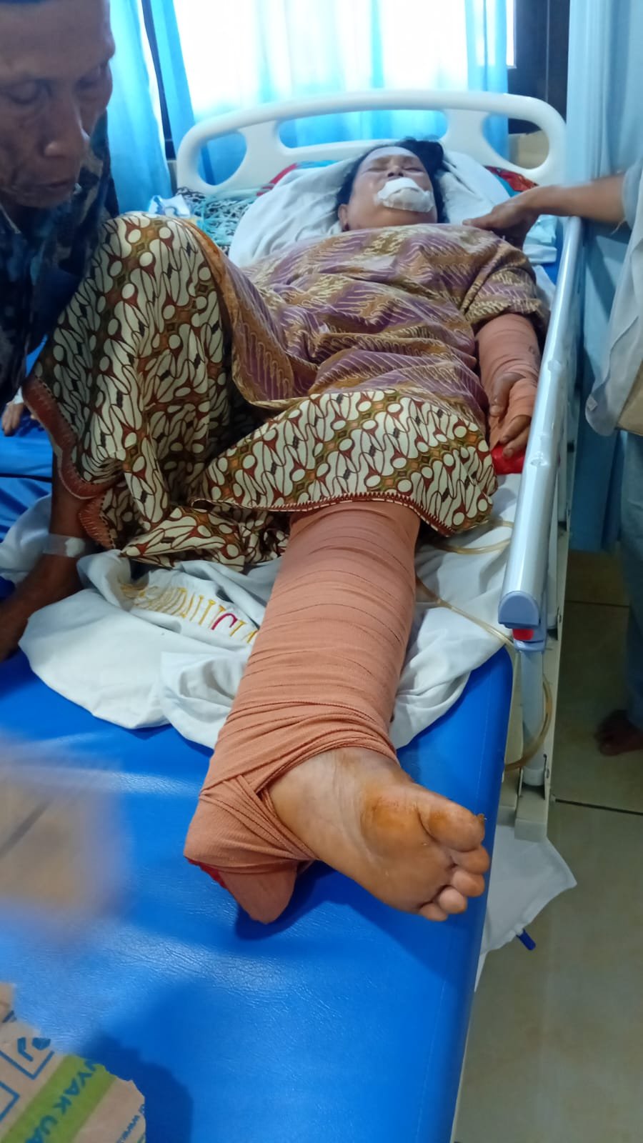 Caption : Salah satu relawan SPPG Cibaliung 2, Kecamatan Cibaliung, Kabupaten Pandeglang, alami luka serius saat ini tengah menjalani perawatan di RSUD Berkah Pandeglang pasca tertabrak mobil pickup.